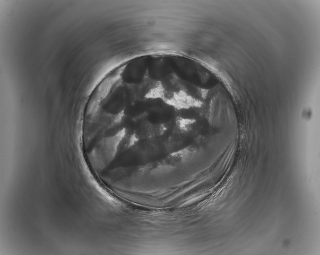 X0000099311383200805161402