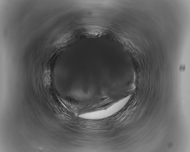 X0000099311394200805161401