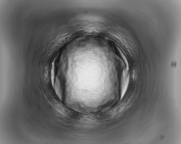 X0000099311396200805161401