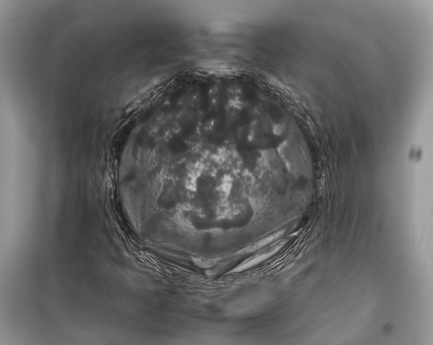 X0000099311397200805161401