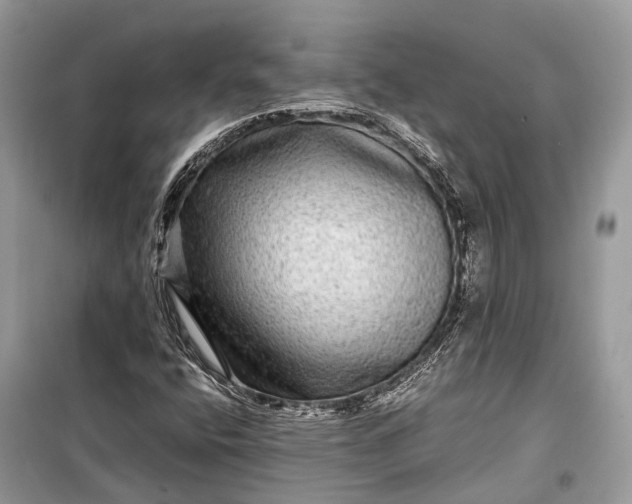 X0000099311400200805161402