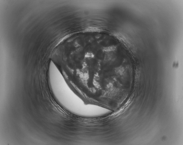 X0000099311401200805161402