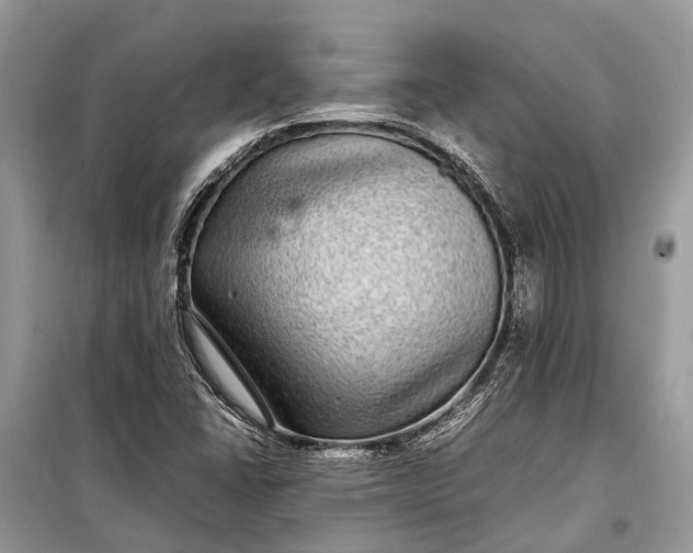 X0000099311406200805161402