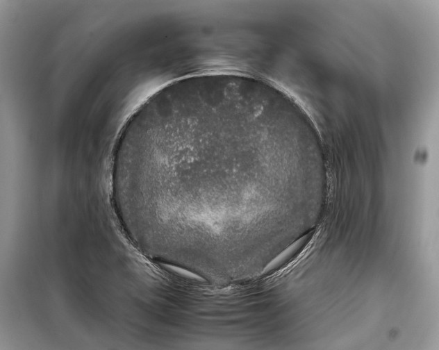 X0000099311415200805161402