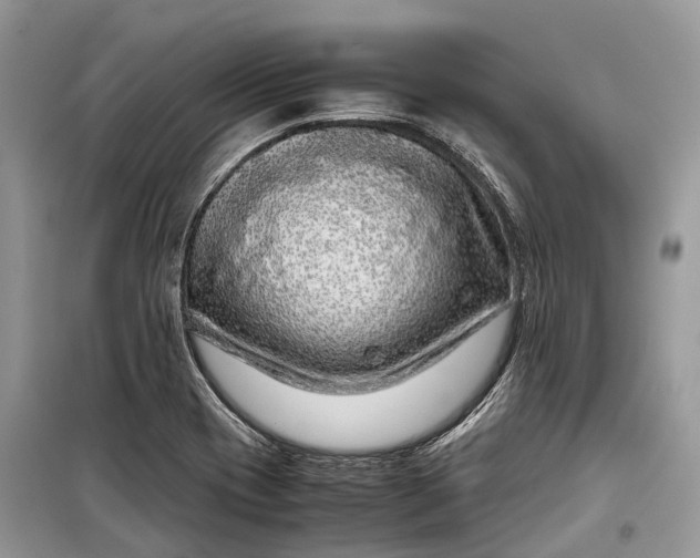 X0000099311417200805161402