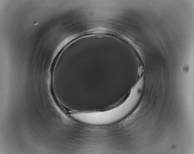 X0000099311418200805161402