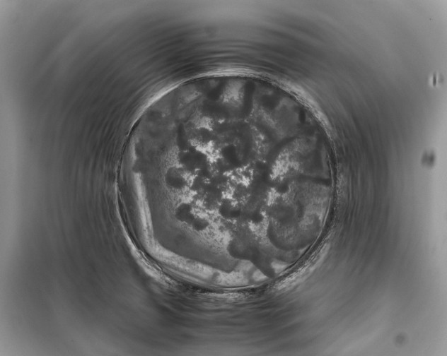 X0000099311425200805161402