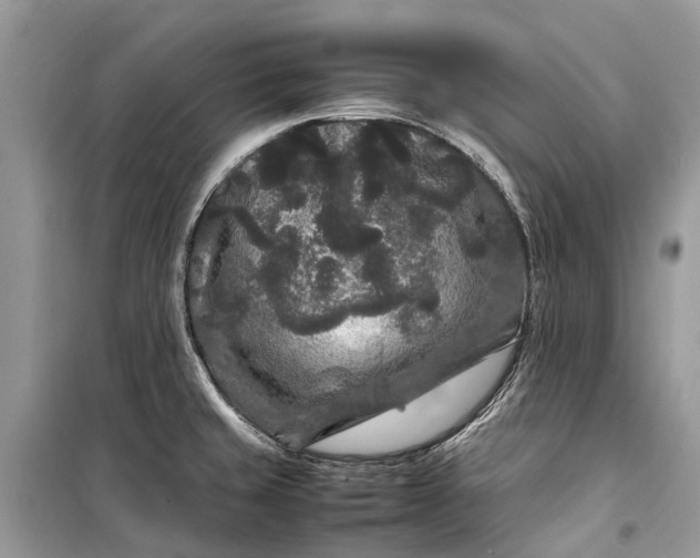 X0000099311429200805161402