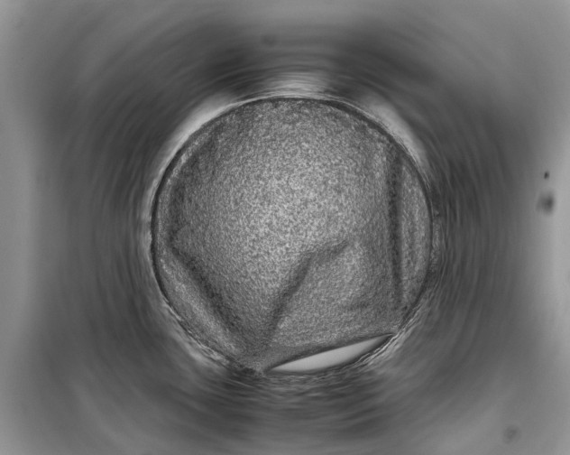 X0000099311435200805161402