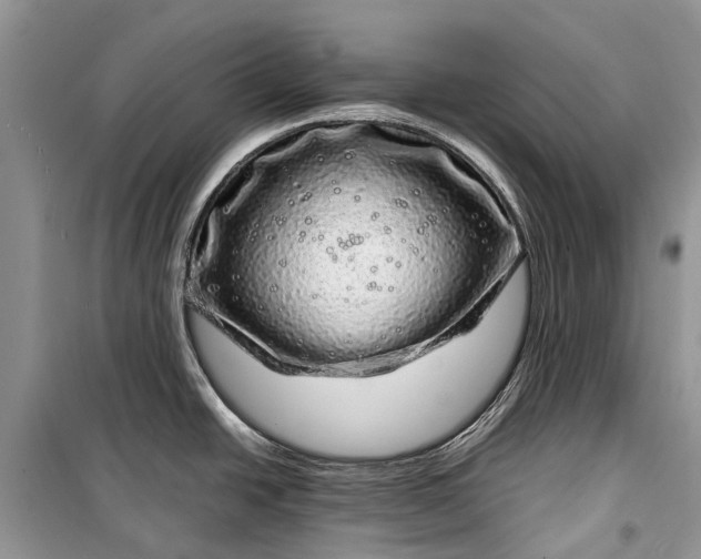 X0000099311438200805161402