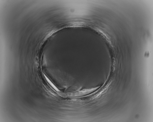 X0000099311449200805161401