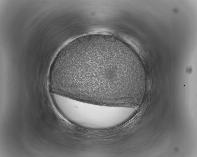 X0000099311471200805161401