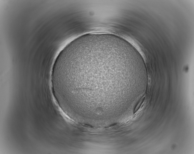 X0000099311485200805161401