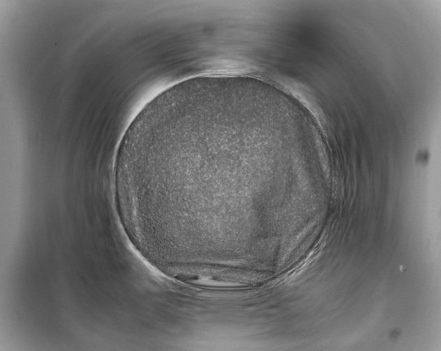 X0000099311487200805161401