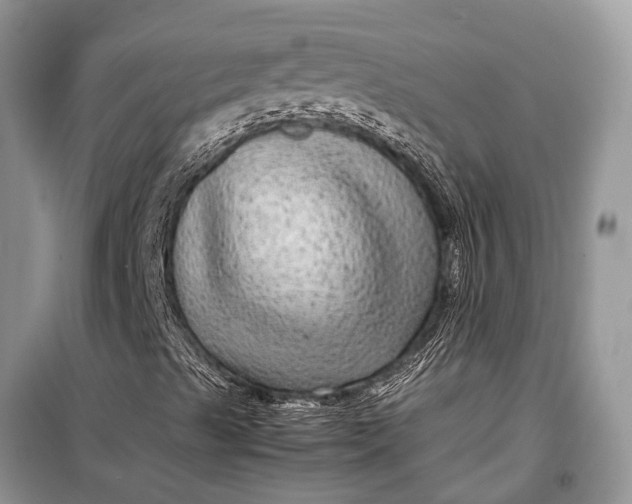 X0000099311489200805161400