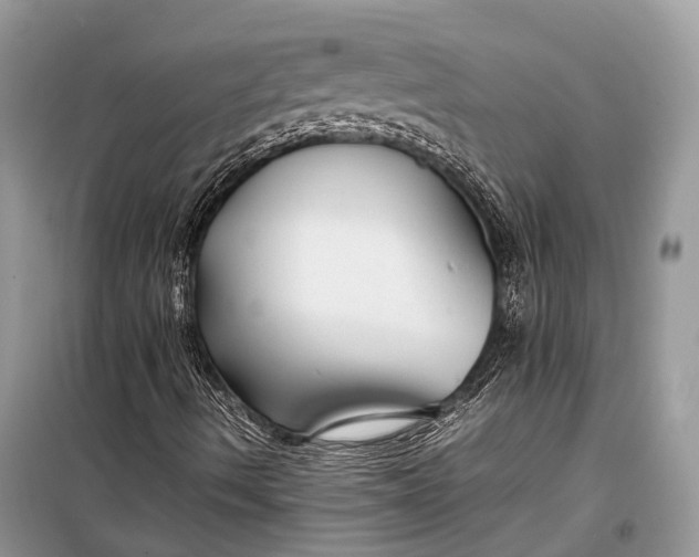 X0000099311490200805161400