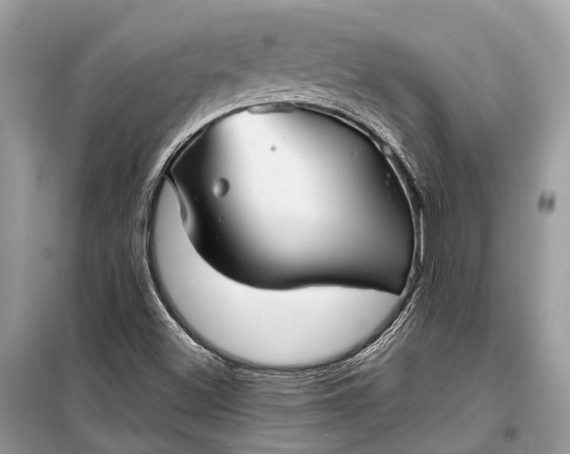 X0000099311500200805161400