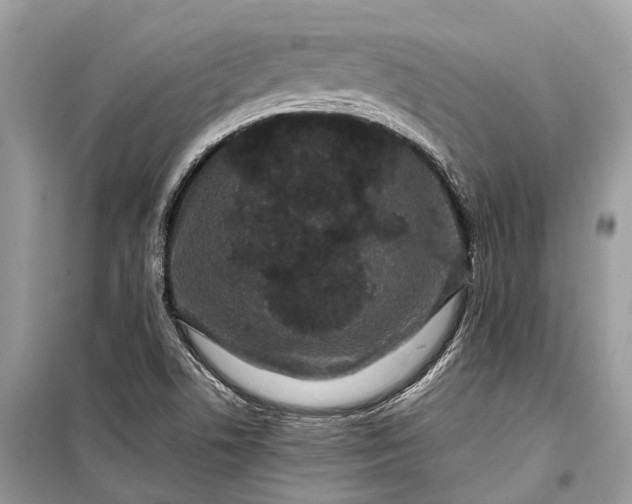 X0000099311506200805161400