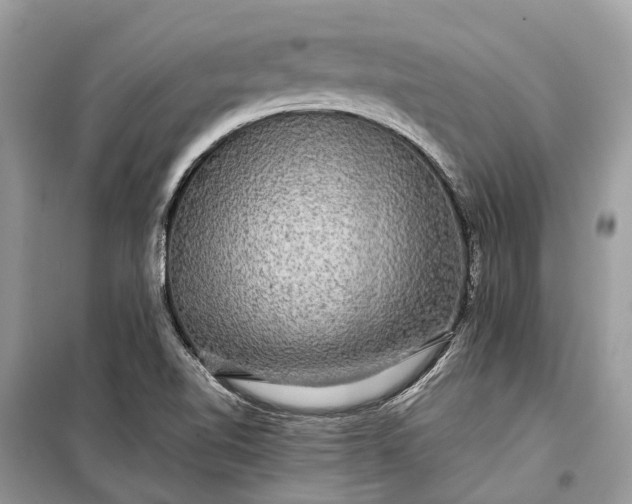 X0000099311510200805161400