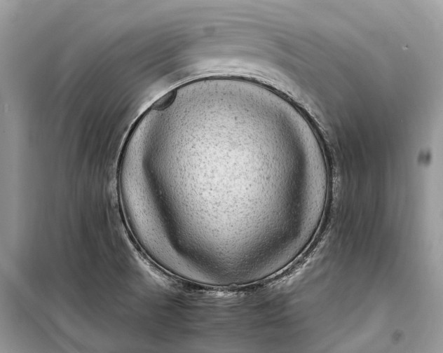 X0000099311521200805161400