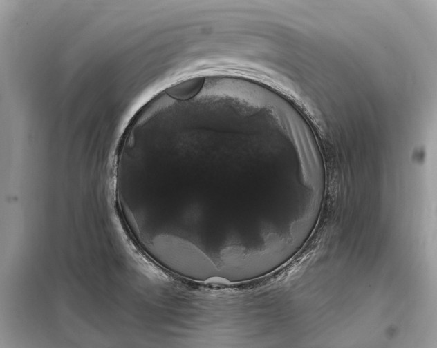 X0000099311522200805161400