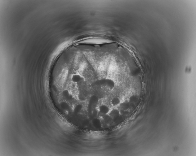 X0000099310149200805231410