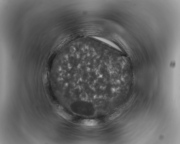 X0000099310169200805231411