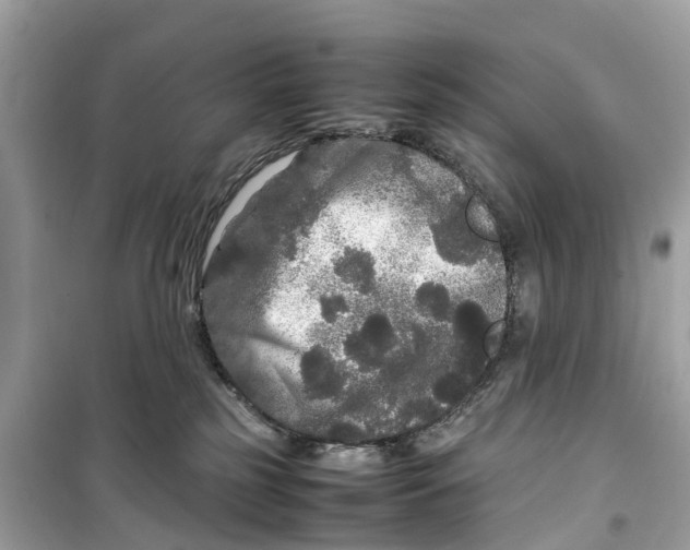 X0000099310185200805231411