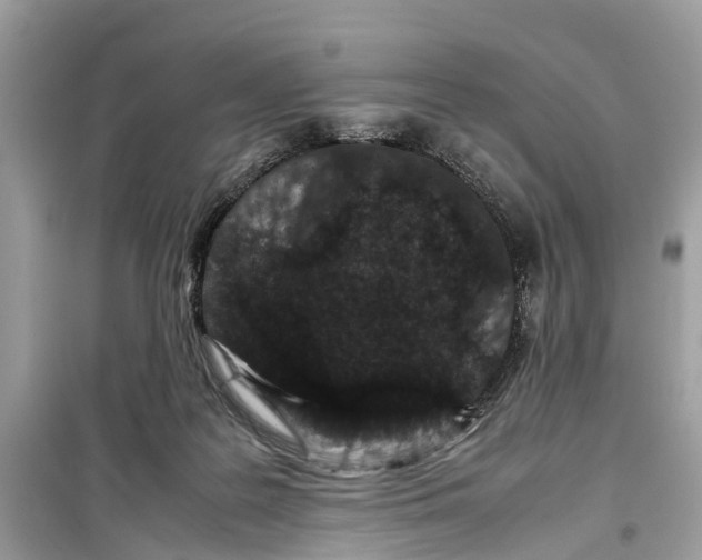 X0000099310219200805231410