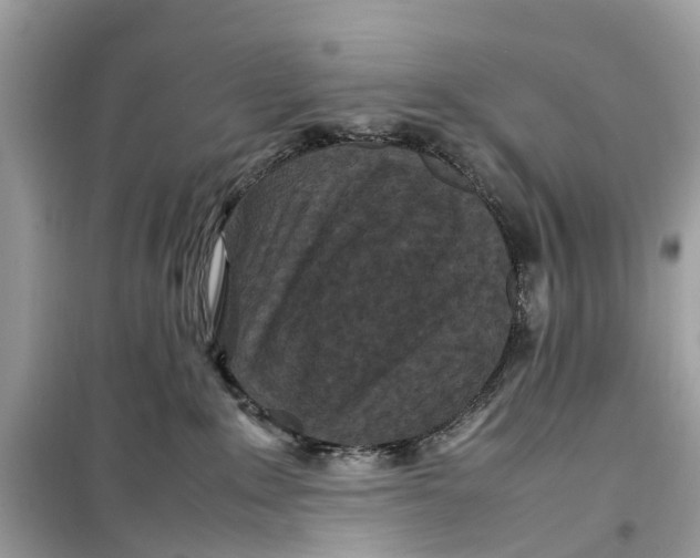 X0000099310235200805231410