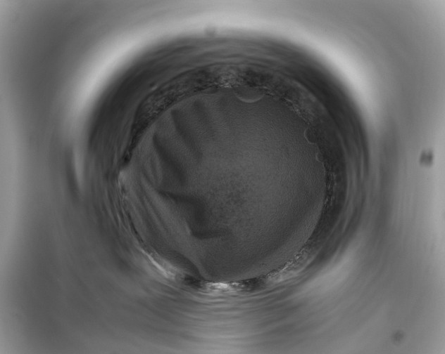 X0000099310239200805231410