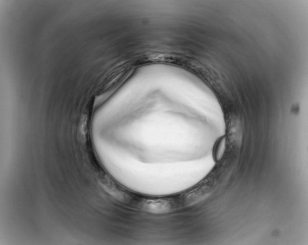 X0000099310275200805231410