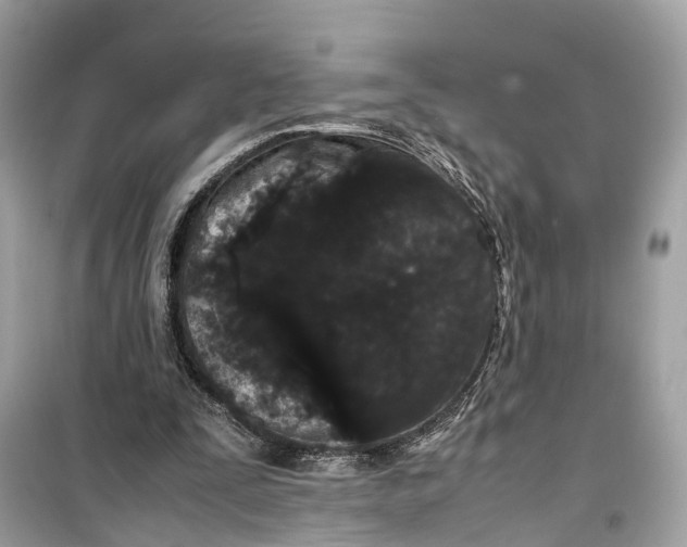 X0000099310295200805231409