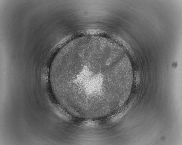 X0000099310356200805231408