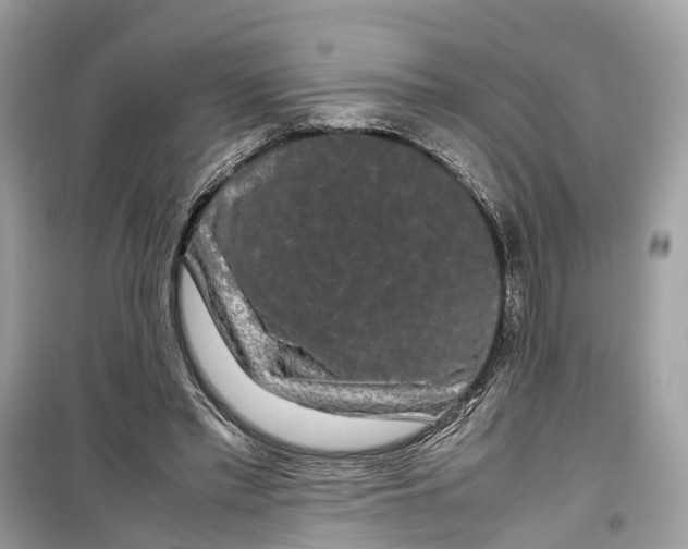 X0000099310397200805231408