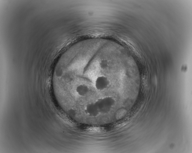 X0000099310499200805231406