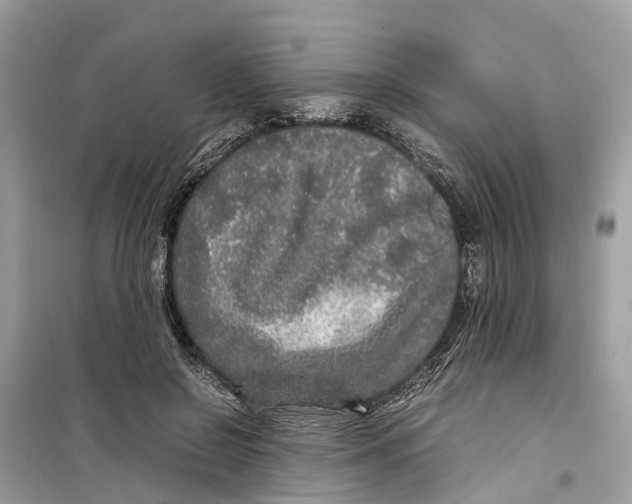 X0000099310550200805231405