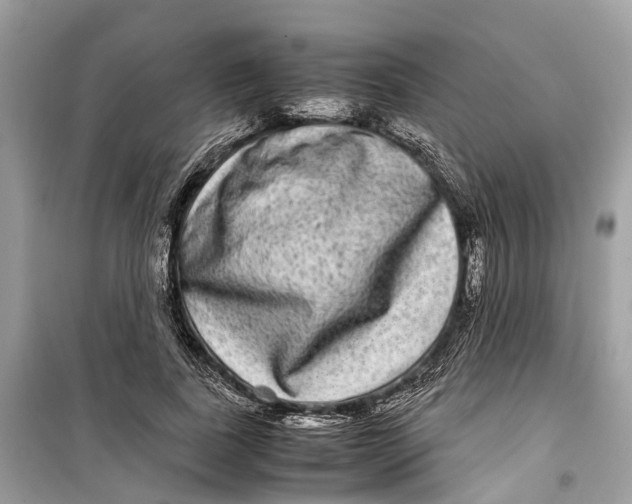 X0000099310739200805231403