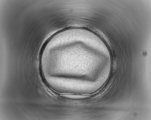 X0000099310787200805231402