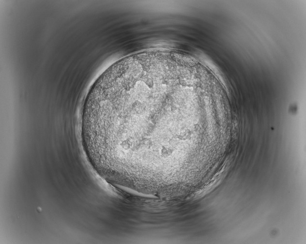 X0000099310859200805231402