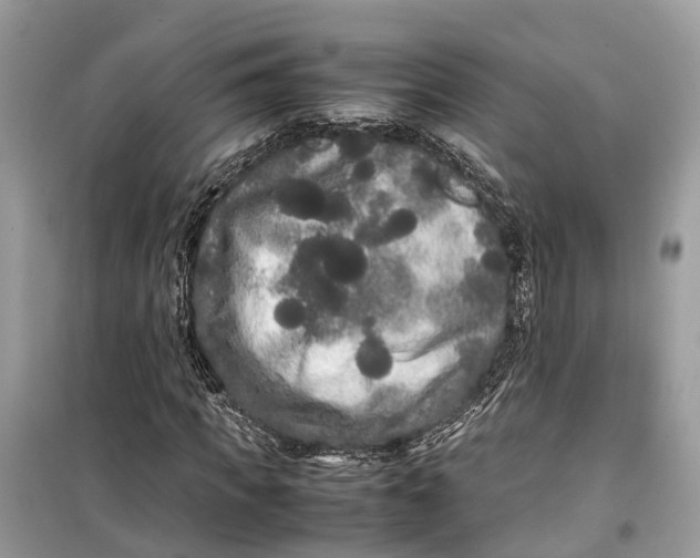 X0000099310917200805231400