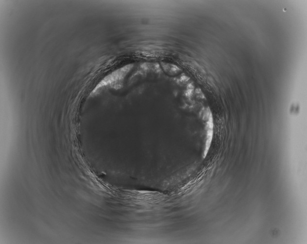 X0000099311009200805231358