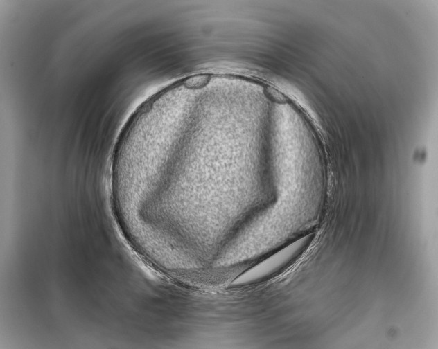 X0000099311040200805231359