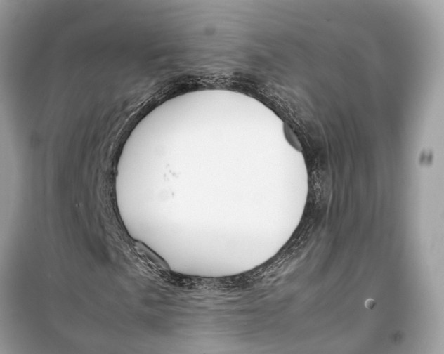 X0000099311057200805231358