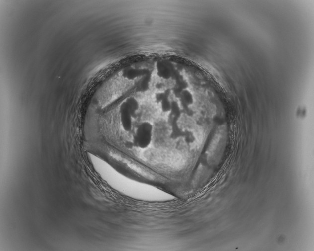 X0000099311063200805231358