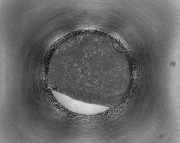 X0000099311064200805231358