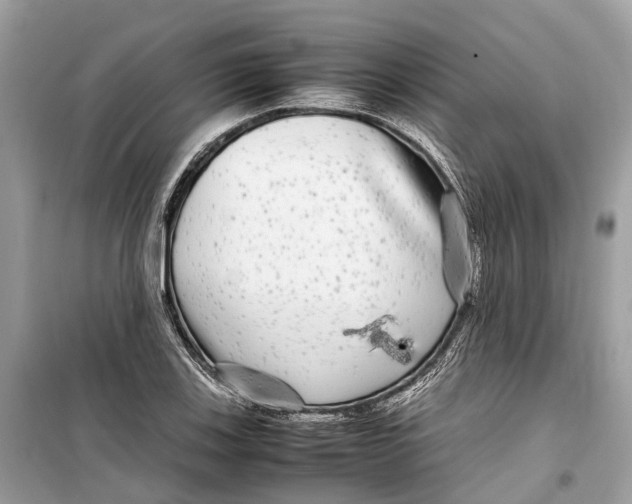 X0000099311123200805231357