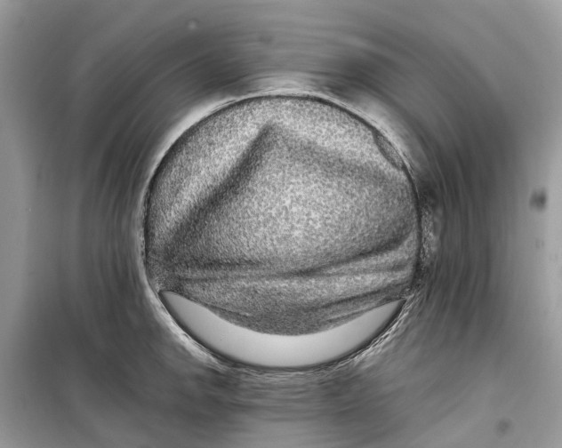 X0000099311142200805231357