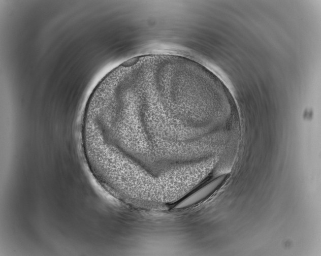 X0000099311152200805231358