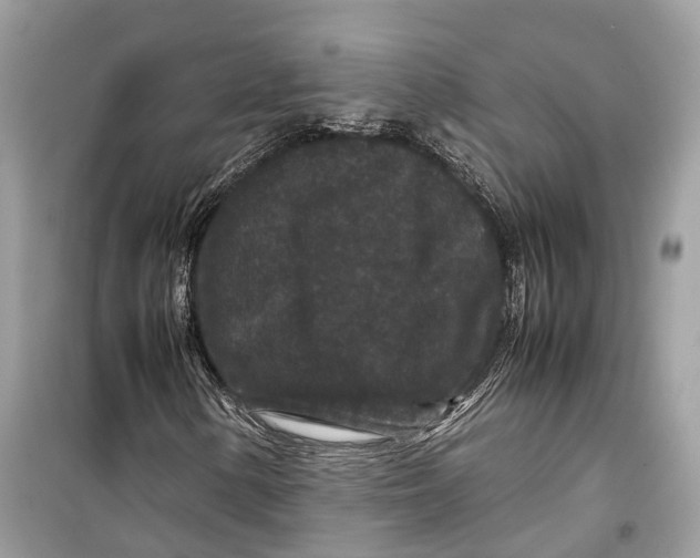 X0000099311154200805231357